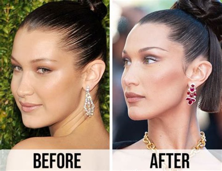 Transformation Journey: Before And After Bella Hadid