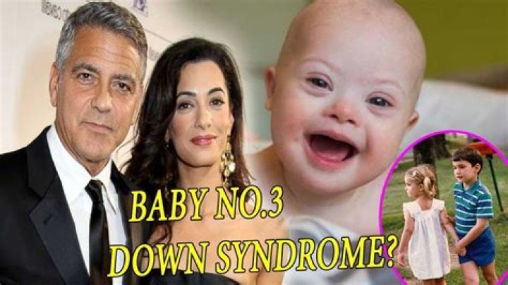 George Clooney's Journey With His Children And Down Syndrome Awareness