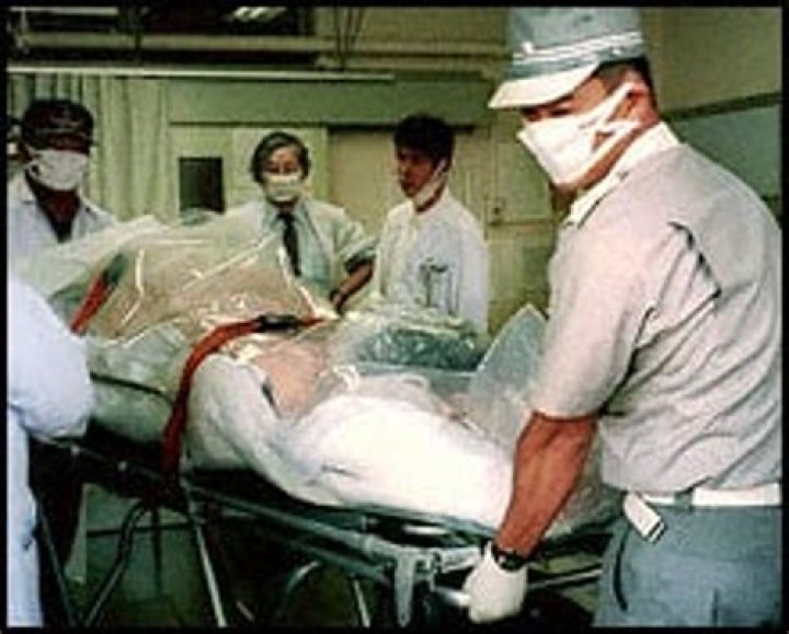 Unraveling The Tragic Tale Of Hisashi Ouchi: The Man Whose Skin Fell Off