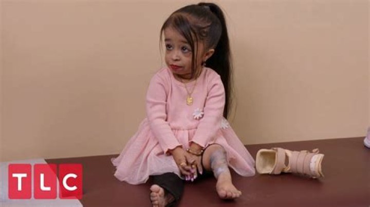 Jyoti Amge Afflicted By The Rarest Disease
