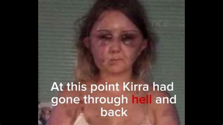 Expert Insights From Kirra Hart | Unlocking Social Media Mastery