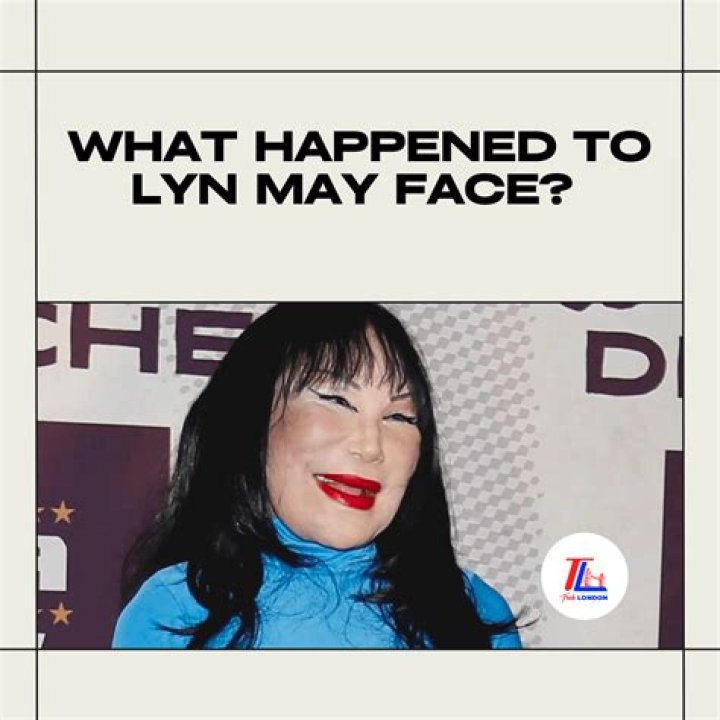 Lyn May: What Happened To The Iconic Star?