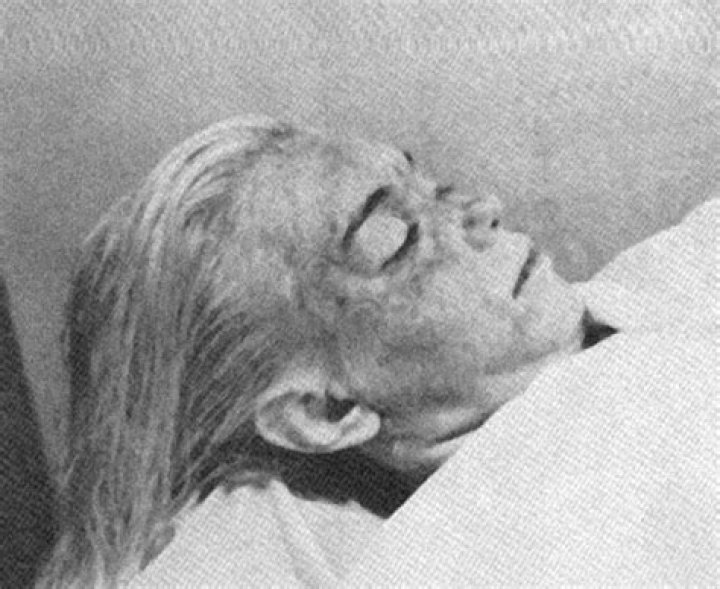 Unveiling The Truth: The Marilyn Monroe Autopsy